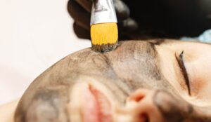 Forradalmi carbon peeling kezelés az Apollon Beauty szalonban